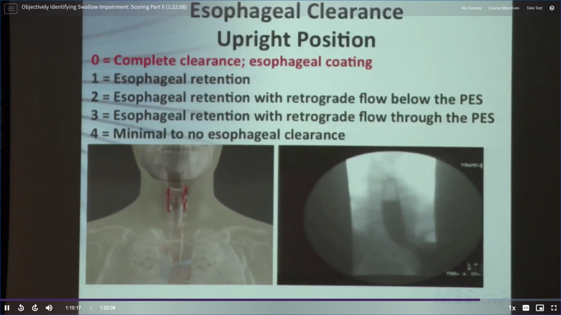 MBSImP Training - Esophageal Clearance
