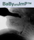 BaByVFSSImP