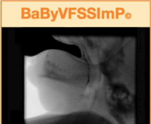 BaByVFSSImP&copy; For Videofluoroscopic Assessment Of Swallowing Impairment In Bottle-Fed Babies
