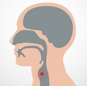 Swallowing Difficulties After Total Laryngectomy