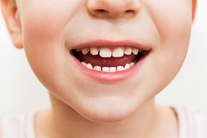 Using Myofunctional Assessment and Treatment Methods To Improve Feeding and Swallowing Behaviors