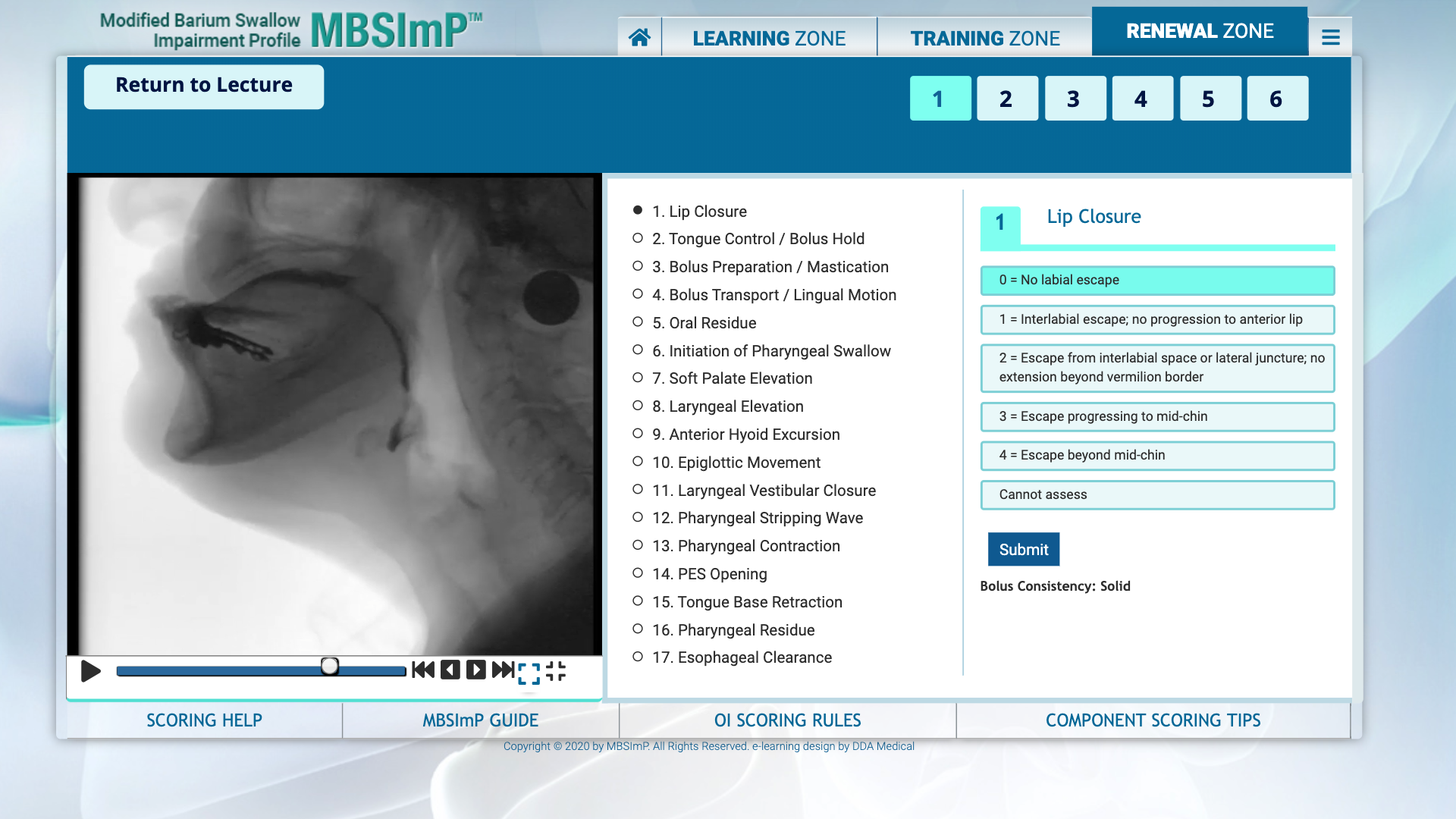 MBSImP Renewal - Dysphagia Assessment 